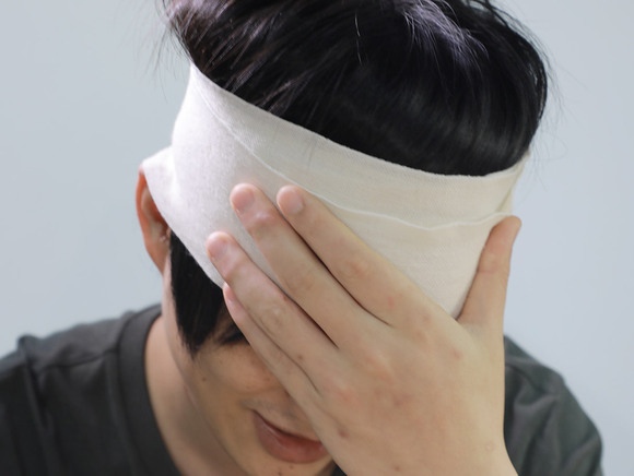 面部缝四针能赔多少钱