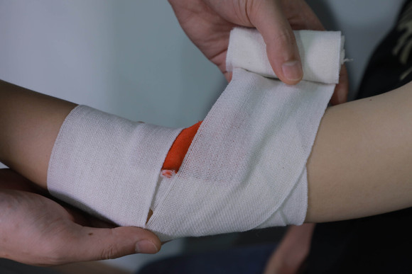 面部伤鉴什么时候做最好